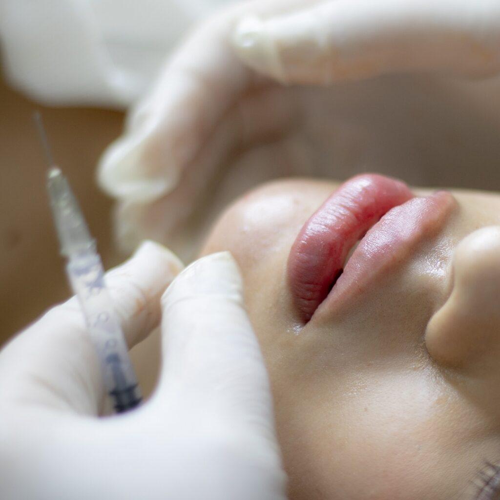 збільшення губ