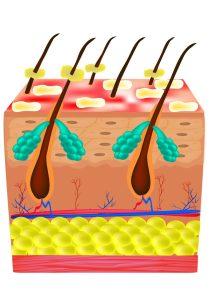 себорейний дерматит